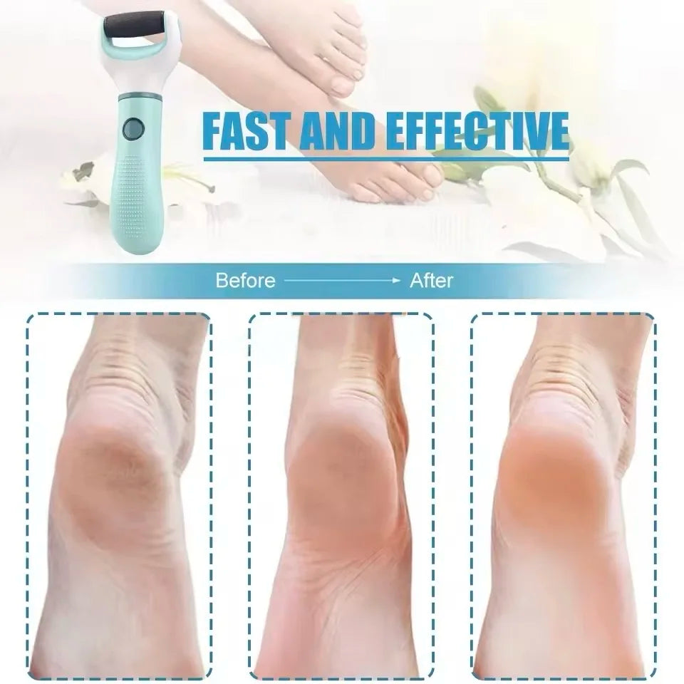 Ponceuse électrique pour pieds ⚡🦶