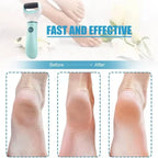 Ponceuse électrique pour pieds ⚡🦶